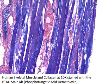 PTAH Histology Stain Kit (Phosphotungstic Acid Hemat…